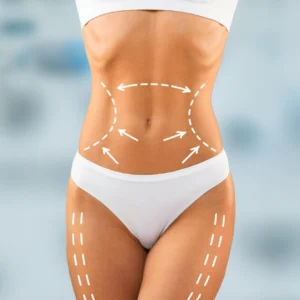 Mastopexia + Implantes